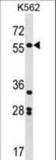 SOX11 Antibody western blot of K562 cell line lysates (35 ug/lane). The SOX11 antibody detected the SOX11 protein (arrow).