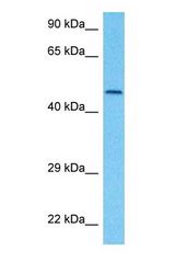 Western blot of SOX11 Antibody with human Jurkat Whole Cell lysate.
