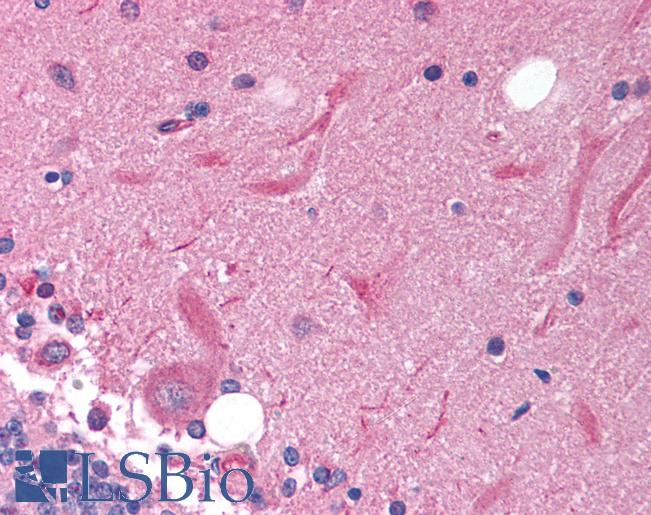 Anti-SOX11 antibody IHC of human brain, cerebellum. Immunohistochemistry of formalin-fixed, paraffin-embedded tissue after heat-induced antigen retrieval. Antibody LS-B1567 concentration 5 ug/ml.