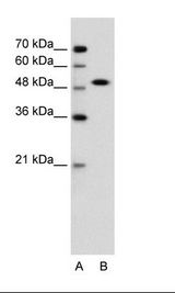 A: Marker, B: Jurkat Cell Lysate