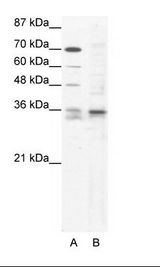 A: Marker, B: HepG2 Cell Lysate