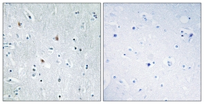 IHC of paraffin-embedded human brain tissue, using SOX12 Antibody. The sample on the right was incubated with synthetic peptide.