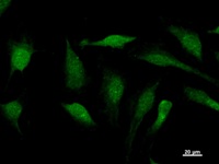 Immunostaining analysis in HeLa cells. HeLa cells were fixed with 4% paraformaldehyde and permeabilized with 0.1% Triton X-100 in PBS. The cells were immunostained with anti-SOX12 mAb.