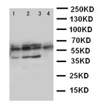 WB of PTHR / PTHR1 antibody. Lane 1: SKOV Cell Lysate. Lane 2: U20S Cell Lysate. Lane 3: HELA Cell Lysate. Lane 4: SMMC Cell Lysate.