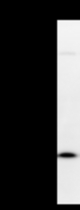 Detection of human SOX12 by Western blot. Samples: Whole cell lysate (25 ug) from HT-1080 cells. Predicted molecular weight: 34 kDa
