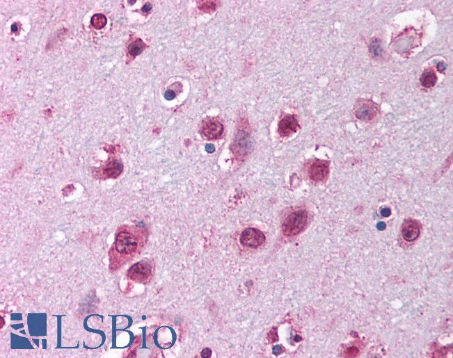 Anti-SOX12 antibody IHC of human brain, cortex. Immunohistochemistry of formalin-fixed, paraffin-embedded tissue after heat-induced antigen retrieval. Antibody LS-B1568 concentration 5 ug/ml.