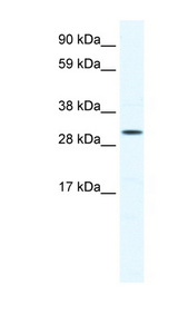 SOX12 antibody LS-B1568 Western blot of Jurkat lysate.