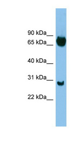 SOX13 antibody LS-C115971 Western blot of ACHN lysate.