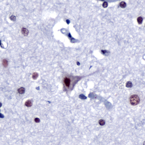 Immunohistochemistry of Human Fetal Brain stained with anti-SOX-14 antibody