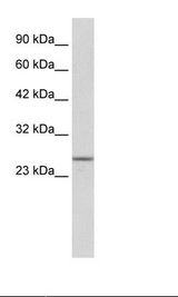 HepG2 Cell Lysate