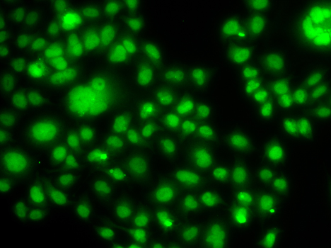 Immunofluorescence blot of MCF7 cell using SOX14 antibody.