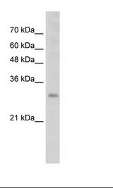 Transfected 293T Cell Lysate