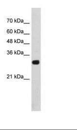 Transfected 293T Cell Lysate