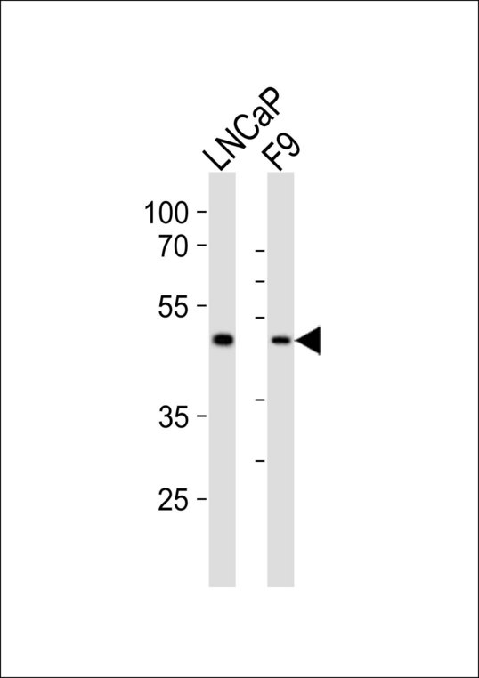 Western blot of lysates from LNCaP, mouse F9 cell line (from left to right) with Sox17 Antibody. Antibody was diluted at 1:1000 at each lane. A goat anti-rabbit IgG H&L (HRP) at 1:10000 dilution was used as the secondary antibody. Lysates at 20 ug per lane.