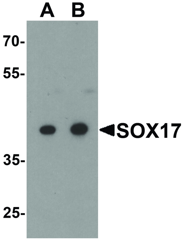 Western blot analysis of SOX17 in HepG2 cell lysate with SOX17 antibody at (A) 0.5 and (B) 1 ug/ml.