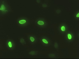 Immunofluorescent staining of HeLa cells using anti-SOX17 mouse monoclonal antibody.