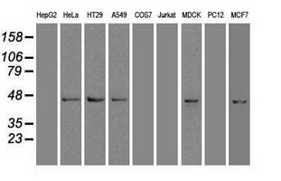 Anti-SOX17 mouse monoclonal antibody immunofluorescent staining of HeLa cells transiently transfected by pCMV6-ENTRY SOX17.