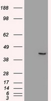 HEK293T cells were transfected with the pCMV6-ENTRY control (Left lane) or pCMV6-ENTRY SOX17 (Right lane) cDNA for 48 hrs and lysed. Equivalent amounts of cell lysates (5 ug per lane) were separated by SDS-PAGE and immunoblotted with anti-SOX17.