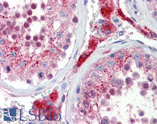 Anti-SOX17 antibody IHC of human testis. Immunohistochemistry of formalin-fixed, paraffin-embedded tissue after heat-induced antigen retrieval. Antibody LS-B3535 concentration 5 ug/ml.