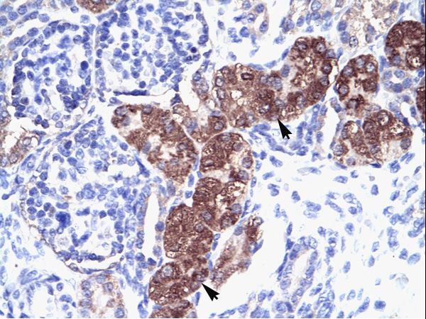 SOX18 antibody LS-C30068 was used in IHC to stain formalin-fixed, paraffin-embedded human kidney.