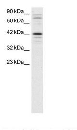 Jurkat Cell Lysate