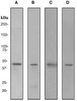Western blot analysis on (A) K562, (B) human stomach, (C) Jurkat, and (D) HeLa cell lysates using anti-SOX18 antibody.