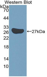 Western blot of recombinant SOX18.