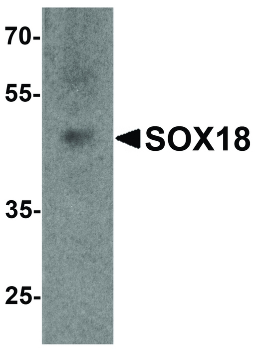 Western blot analysis of SOX18 in 3T3 cell lysate with SOX18 antibody at 1 ug/ml.