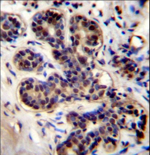 PROX2 Antibody immunohistochemistry of formalin-fixed and paraffin-embedded human breast tissue followed by peroxidase-conjugated secondary antibody and DAB staining.