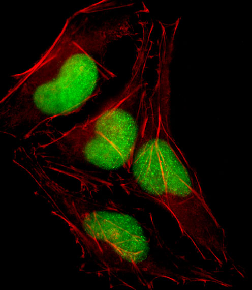 Fluorescent confocal image of HeLa cell stained with SOX18 Antibody. HeLa cells were fixed with 4% PFA (20 min), permeabilized with Triton X-100 (0.1%, 10 min), then incubated with SOX18 primary antibody (1:25, 1 h at 37°C). For secondary antibody, Alexa Fluor 488 conjugated donkey anti-rabbit antibody (green) was used (1:400, 50 min at 37°C). Cytoplasmic actin was counterstained with Alexa Fluor 555 (red) conjugated Phalloidin (7units/ml, 1 h at 37°C). Nuclei were counterstained with DAPI (blue) (10 ug/ml, 10 min). SOX18 immunoreactivity is localized to Nucleus significantly.