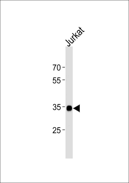 SOX18 Antibody western blot of Jurkat cell line lysates (35 ug/lane). The SOX18 antibody detected the SOX18 protein (arrow).
