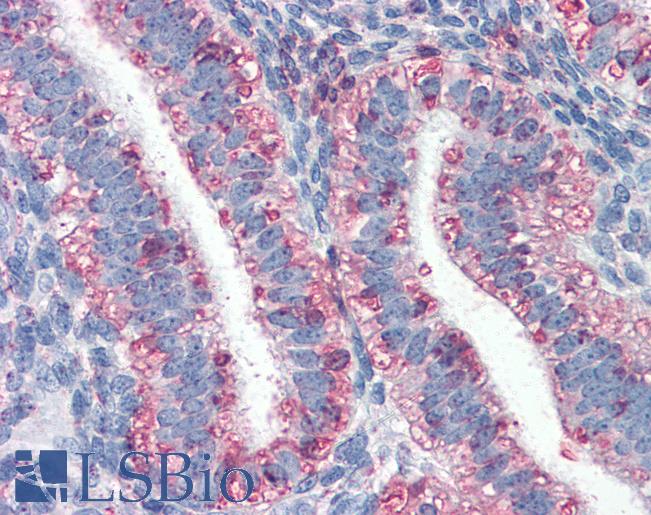 Anti-SOX18 antibody IHC of human uterus. Immunohistochemistry of formalin-fixed, paraffin-embedded tissue after heat-induced antigen retrieval. Antibody LS-B3089 concentration 10 ug/ml.