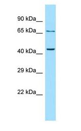 PTHR2 / PTH2R antibody Western Blot of OVCAR-3.