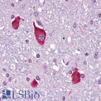Anti-PTH2R / PTHR2 antibody LS-A250 IHC of human brain, neurons and glia. Immunohistochemistry of formalin-fixed, paraffin-embedded tissue after heat-induced antigen retrieval.