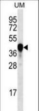 PROX2 Antibody western blot of uterus tumor cell line lysates (35 ug/lane). The PROX2 antibody detected the PROX2 protein (arrow).