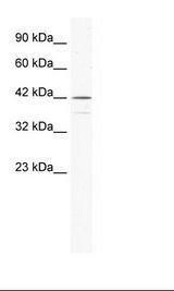 Raji Cell Lysate