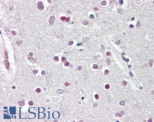 Anti-SOX3 antibody IHC of human brain, cortex. Immunohistochemistry of formalin-fixed, paraffin-embedded tissue after heat-induced antigen retrieval. Antibody LS-B8332 dilution 3.75 ug/ml.