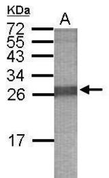 Anti-SOX4 antibody used in Western blot.