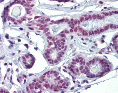 SOX4 antibody Western Blot of Human Testis.