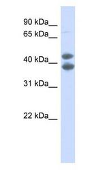 SOX4 antibody Western Blot of Fetal kidney lysate.