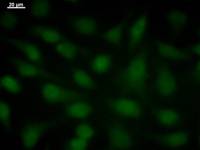 Immunostaining analysis in HeLa cells. HeLa cells were fixed with 4% paraformaldehyde and permeabilized with 0.1% Triton X-100 in PBS. The cells were immunostained with anti-SOX4 mAb.