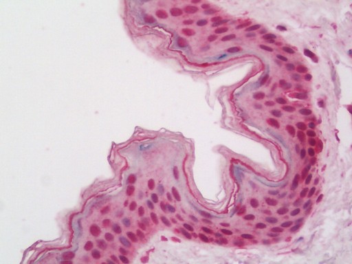 Human Skin: Formalin-Fixed, Paraffin-Embedded (FFPE)