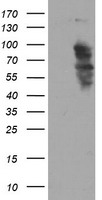 HEK293T cells were transfected with the pCMV6-ENTRY control (Left lane) or pCMV6-ENTRY SOX5 (Right lane) cDNA for 48 hrs and lysed. Equivalent amounts of cell lysates (5 ug per lane) were separated by SDS-PAGE and immunoblotted with anti-SOX5.