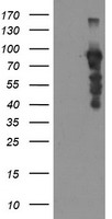 HEK293T cells were transfected with the pCMV6-ENTRY control (Left lane) or pCMV6-ENTRY SOX5 (Right lane) cDNA for 48 hrs and lysed. Equivalent amounts of cell lysates (5 ug per lane) were separated by SDS-PAGE and immunoblotted with anti-SOX5.
