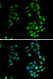 Immunofluorescence blot of U20S cell using SOX5 antibody. Blue: DAPI for nuclear staining.