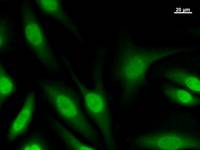 Immunostaining analysis in HeLa cells. HeLa cells were fixed with 4% paraformaldehyde and permeabilized with 0.1% Triton X-100 in PBS. The cells were immunostained with anti-SOX5 mAb.