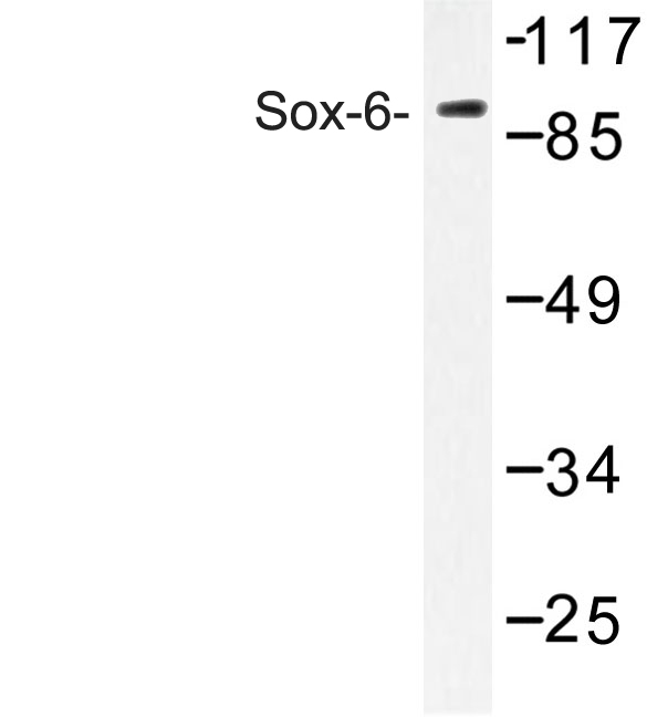 Western blot of Sox-6 (D23) pAb in extracts from Jurkat cells.