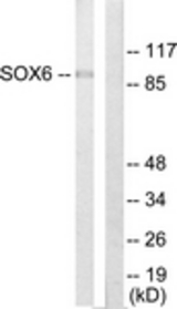 Western blot of extracts from Jurkat cells, using SOX6 Antibody. The lane on the right is treated with the synthesized peptide.