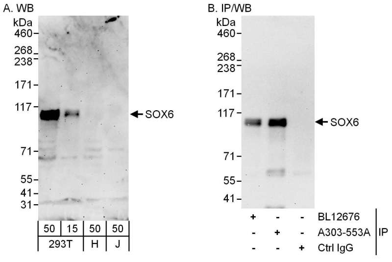 Detection of Human SOX6 by Western Blot and Immunoprecipitation. Samples: Whole cell lysate from 293T (15 and 50 ug for WB; 1 mg for IP, 20% of IP loaded), HeLa (H; 50 ug) and Jurkat (J; 50 ug) cells. Antibodies: Affinity purified rabbit anti-SOX6 antibody used for WB at 0.4 ug/ml (A) and 1 ug/ml (B) and used for IP at 6 ug/mg lysate. SOX6 was also immunoprecipitated by rabbit anti-SOX6 antibody BL12676, which recognizes an upstream epitope. Detection: Chemiluminescence with exposure times of 3 minutes (A) and 30 seconds (B).