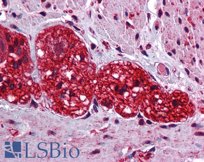 Anti-SOX6 antibody IHC of human colon, myenteric plexus. Immunohistochemistry of formalin-fixed, paraffin-embedded tissue after heat-induced antigen retrieval. Antibody LS-B5596 concentration 2.5 ug/ml.